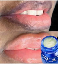 Aloe Lip Lightening Balm – Dark Lip Corrector & Moisturizing Gloss