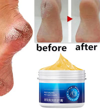 Cracked Heel & Hand Repair Cream – Moisturizing & Whitening Treatment