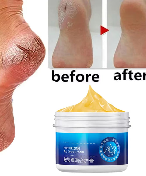 Cracked Heel & Hand Repair Cream – Moisturizing & Whitening Treatment