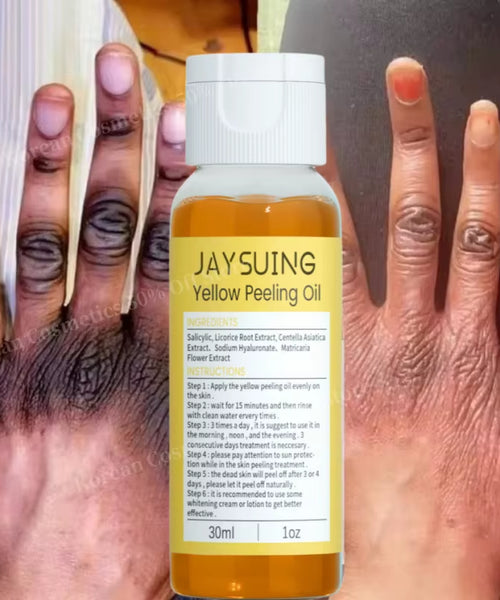 Yellow Peeling Oil – Exfoliates, Whitens & Moisturizes for Smooth, Glowing Skin.