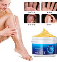 Cracked Heel & Hand Repair Cream – Moisturizing & Whitening Treatment