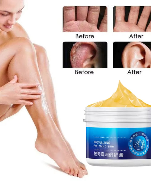 Cracked Heel & Hand Repair Cream – Moisturizing & Whitening Treatment